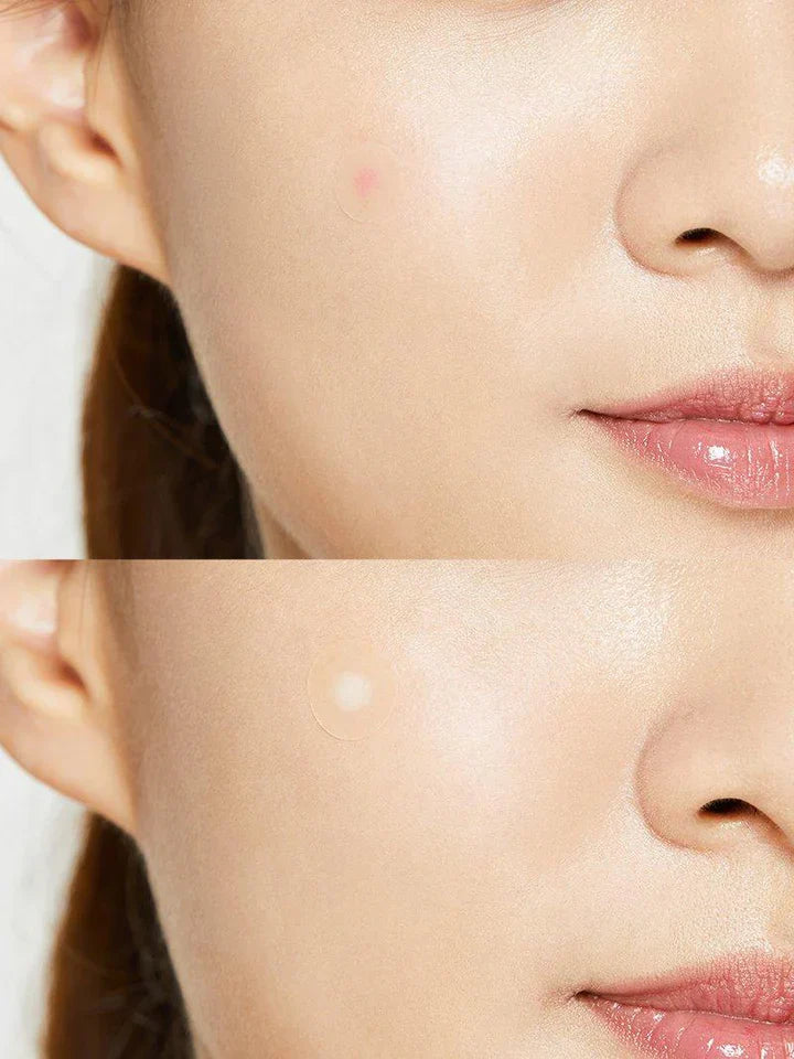 COSRX akne plaastrid „Acne Pimple Master Patch“ 24 tk