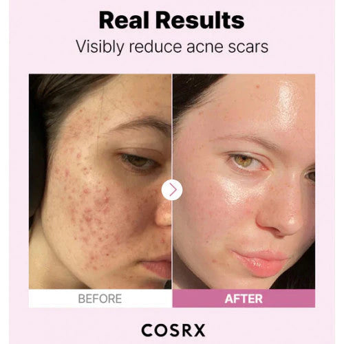COSRX The Niacinamide 15 seerum 20 ml
